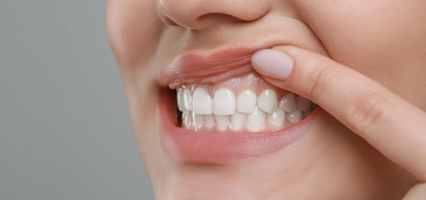 Soin des gencives et surfaçage radiculaire